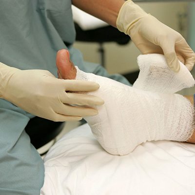 diyabetik-ayak-yarasi